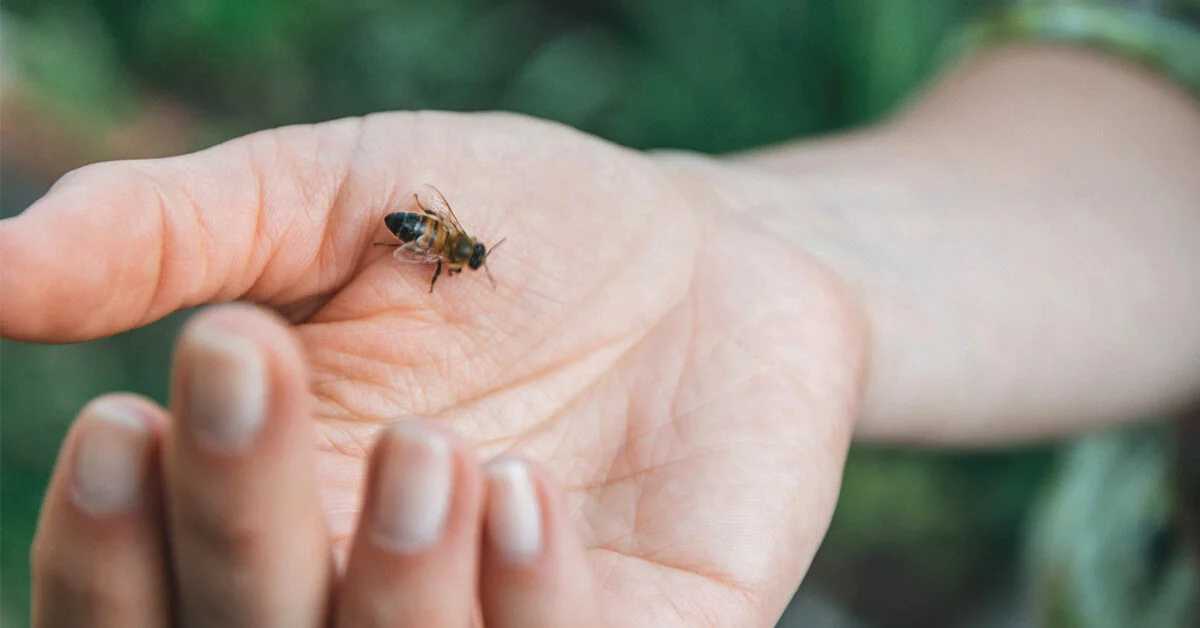Ways To Treat Bee Stings